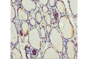 Immunohistochemistry of paraffin-embedded human thyroid tissue using ABIN7159798 at dilution of 1:100 (MTUS1 anticorps  (AA 1041-1270))
