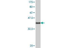 Western Blot detection against Immunogen (36. (CRELD2 anticorps  (AA 162-258))