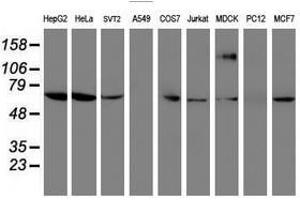 Image no. 3 for anti-Folate Hydrolase (Prostate-Specific Membrane Antigen) 1 (FOLH1) antibody (ABIN1500454) (PSMA anticorps)