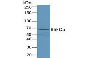 Detection of PLD in Porcine Small Intestine Tissue using Polyclonal Antibody to Phospholipase D (PLD)