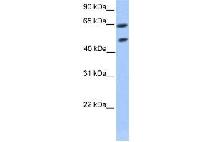 WB Suggested Anti-ZNF449 Antibody Titration: 0. (ZNF449 anticorps  (Middle Region))