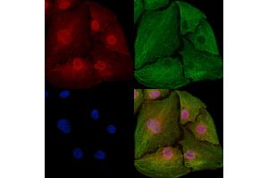 ABIN6259941 and ABIN6273031 staining  cells by IF/ICC. (Annexin VII anticorps  (N-Term))