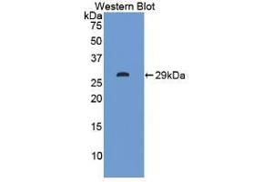 Detection of Recombinant ITLN1, Human using Polyclonal Antibody to Intelectin 1 (ITLN1) (ITLN1/Omentin anticorps  (AA 31-253))