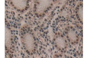 Detection of HDGF in Human Stomach Tissue using Polyclonal Antibody to Hepatoma Derived Growth Factor (HDGF) (HDGF anticorps  (AA 10-240))