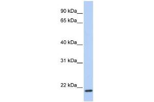 TMEM35 antibody used at 1 ug/ml to detect target protein. (TMEM35 anticorps  (C-Term))