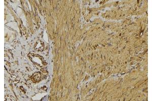 ABIN6269110 at 1/100 staining Mouse muscle tissue by IHC-P. (beta 2 Adrenergic Receptor anticorps  (C-Term))