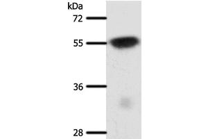 Western Blot analysis of Mouse brain tissue using SLC32A1 Polyclonal Antibody at dilution of 1:950 (SLC32A1 anticorps)