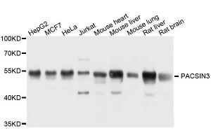Western blot analysis of extracts of various cell lines, using PACSIN3 antibody. (PACSIN3 anticorps  (AA 175-424))