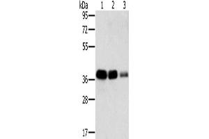 Gel: 8 % SDS-PAGE, Lysate: 40 μg, Lane 1-3: A549 cells, HT29 cells, A172 cells, Primary antibody: ABIN7130292(MTFR1 Antibody) at dilution 1/500, Secondary antibody: Goat anti rabbit IgG at 1/8000 dilution, Exposure time: 5 seconds (MTFR1 anticorps)