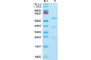 Biotinylated Human PLAU/uPA (activated by trypsin) on Tris-Bis PAGE under reduced condition.