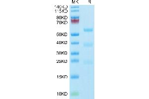 PLAU Protein (AA 21-431) (His-Avi Tag,Biotin)