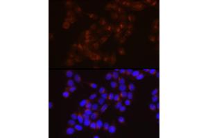 Immunofluorescence analysis of HeLa cells using LDL Receptor (LDLR) Rabbit mAb  at dilution of 1:150 (40x lens). (LDLR anticorps)