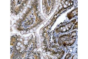 IHC analysis of CSNK2K2 using anti-CSNK2K2 antibody (ABIN7602871).