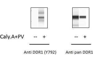 Jurkat cells were treated with Calyculin A and Pervanadate.