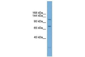 Western Blot showing PARP10 antibody used at a concentration of 1-2 ug/ml to detect its target protein.