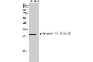 Western Blotting (WB) image for anti-Cardiac Troponin C (TNNC1) (pSer22), (pSer23) antibody (ABIN3182561) (TNNC1 anticorps  (pSer22, pSer23))