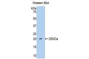 Western Blotting (WB) image for anti-Pim-1 Oncogene (PIM1) (AA 38-177) antibody (ABIN1078444) (PIM1 anticorps  (AA 38-177))