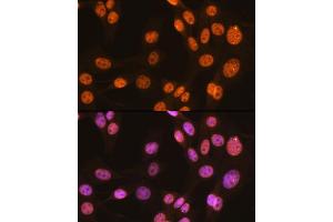 Immunofluorescence analysis of NIH-3T3 cells using PTBP1 Rabbit mAb (ABIN7269464) at dilution of 1:100 (40x lens).