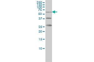RIOK3 monoclonal antibody (M02), clone 3G11 Western Blot analysis of RIOK3 expression in K-562 . (RIOK3 anticorps  (AA 411-516))