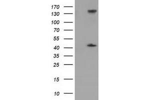 Western Blotting (WB) image for anti-phosphoribosylaminoimidazole Carboxylase, phosphoribosylaminoimidazole Succinocarboxamide Synthetase (PAICS) antibody (ABIN1500021) (PAICS anticorps)