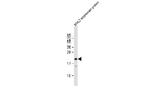 Anti-MLL2 Antibody  at 1:27000 dilution + HL2 recombinant protein Lysates/proteins at 20 μg per lane. (MLL2 anticorps  (C-Term))
