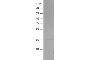 Cystatin C (CST3) (AA 29-148) protein (His tag)
