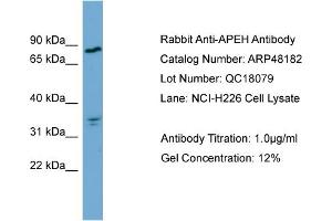 WB Suggested Anti-APEH  Antibody Titration: 0. (APEH anticorps  (Middle Region))