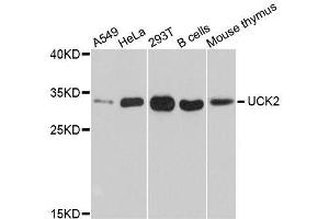 Western blot analysis of extracts of various cell lines, using UCK2 antibody.