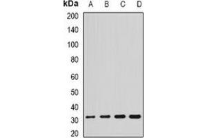 Western blot analysis of SCO2 expression in HL60 (A), SKOV3 (B), mouse brain (C), rat liver (D) whole cell lysates. (SCO2 anticorps)