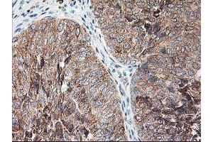 Image no. 6 for anti-Ribophorin 1 (RPN1) antibody (ABIN1500754)