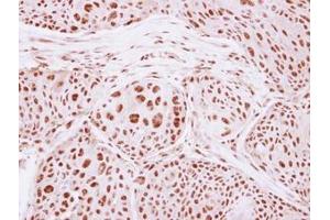 Image no. 1 for anti-General Transcription Factor IIIC, Polypeptide 4 (GTF3C4) (AA 73-334) antibody (ABIN1498564)