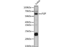 Western blot analysis of extracts of Jurkat cells, using cFLIP antibody (ABIN3016246, ABIN3016247, ABIN3016248 and ABIN6219655) at 1:1000 dilution.