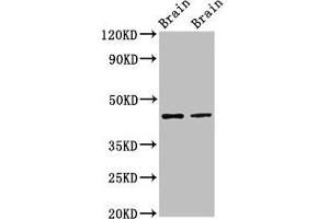 Western Blot Positive WB detected in: Rat brain tissue, Mouse brain tissue All lanes: MAPK3 antibody at 3 μg/mL Secondary Goat polyclonal to rabbit IgG at 1/50000 dilution Predicted band size: 44, 39, 41 kDa Observed band size: 44 kDa (ERK1 anticorps  (AA 11-379))