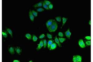 Immunofluorescent analysis of PC-3 cells using ABIN7156122 at dilution of 1:100 and Alexa Fluor 488-congugated AffiniPure Goat Anti-Rabbit IgG(H+L)