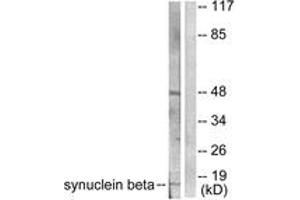 Western blot analysis of extracts from HeLa cells, using Synuclein beta Antibody. (beta Synuclein anticorps  (AA 85-134))
