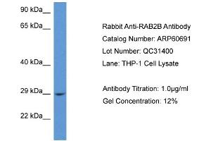 Western Blotting (WB) image for anti-RAB2B, Member RAS Oncogene Family (RAB2B) (C-Term) antibody (ABIN786243) (RAB2B anticorps  (C-Term))