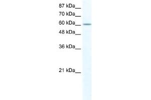 WB Suggested Anti-FUBP1 Antibody Titration:  2.
