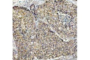 IHC analysis of PDK2 using anti-PDK2 antibody (ABIN5693279). (PDK2 anticorps  (AA 81-177))