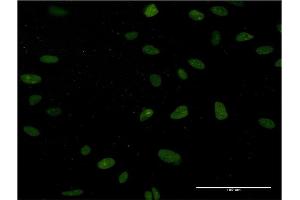 Immunofluorescence of monoclonal antibody to NUCKS1 on HeLa cell. (NUCKS1 anticorps  (AA 1-243))