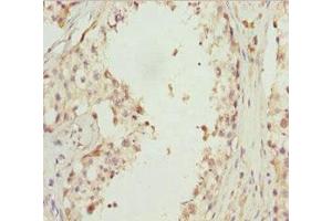 Immunohistochemistry of paraffin-embedded human testis tissue using ABIN7151422 at dilution of 1:100 (EFHC1 anticorps  (AA 391-640))