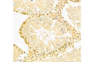 Immunohistochemistry of paraffin embedded mouse testis using COMMD4 (ABIN7073559) at dilution of 1: 800 (300x lens) (COMMD4 anticorps)