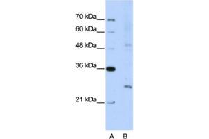 Western Blotting (WB) image for anti-Exosome Component 4 (EXOSC4) antibody (ABIN2462286) (EXOSC4 anticorps)