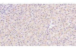 Detection of NT3 in Human Liver Tissue using Monoclonal Antibody to Neurotrophin 3 (NT3) (Neurotrophin 3 anticorps  (AA 130-255))