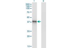 Western Blot analysis of B3GAT3 expression in transfected 293T cell line by B3GAT3 monoclonal antibody (M02), clone 1C11. (B3GAT3 anticorps  (AA 236-335))