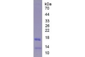 SDS-PAGE of Protein Standard from the Kit (Highly purified E.