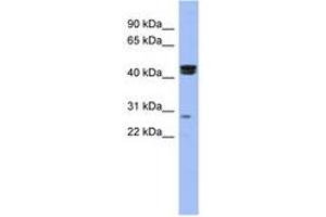 Image no. 1 for anti-Heat Shock Transcription Factor, Y-Linked 1 (HSFY1) (N-Term) antibody (ABIN6742900) (HSFY1 anticorps  (N-Term))