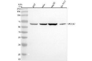Western blot analysis of SPOCK2 using anti-SPOCK2 antibody (ABIN7825851).
