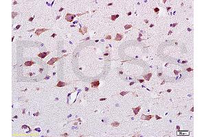 Formalin-fixed and paraffin embedded: rat brain tissue labeled with Anti-CaMK2b Polyclonal Antibody (ABIN669876), Unconjugated at 1:200 followed by conjugation to the secondary antibody and DAB staining