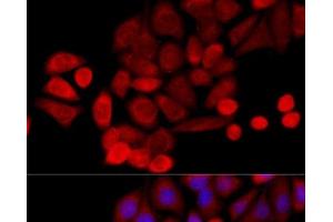 anti-P53-Induced Death Domain Protein (PIDD) antibody