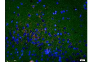 Formalin-fixed and paraffin embedded rat brain labeled with Rabbit Anti Sigma1R/OPRS1/Sigma Receptor Polyclonal Antibody, Unconjugated (ABIN709841) at 1:200, overnight at 4°C.